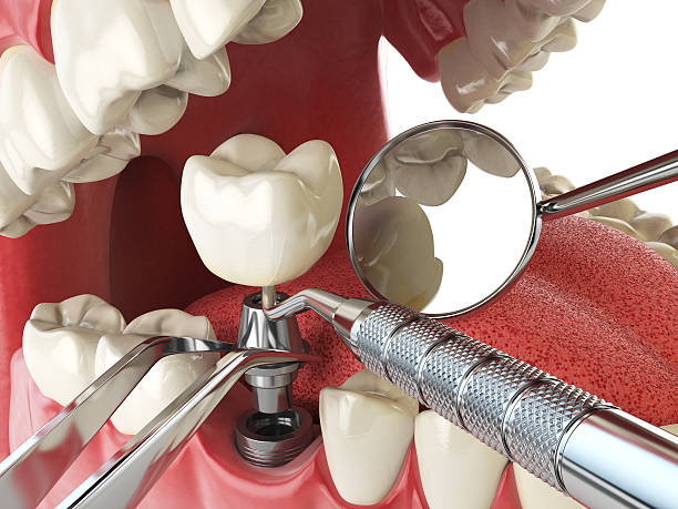 Best After-Hours Dental Trauma Care in North Industry, OH