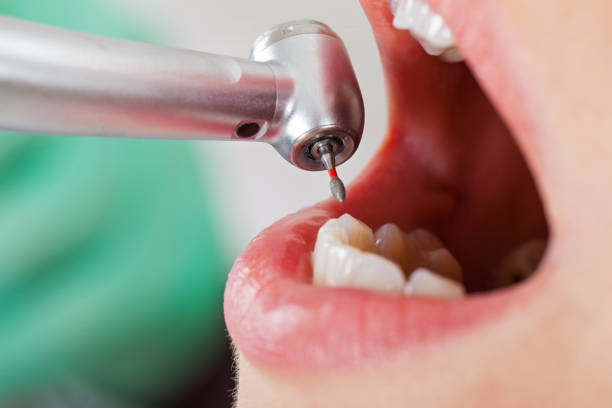 North Industry, OH Emergency Dentist Pros